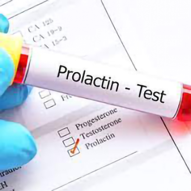 Prolactin