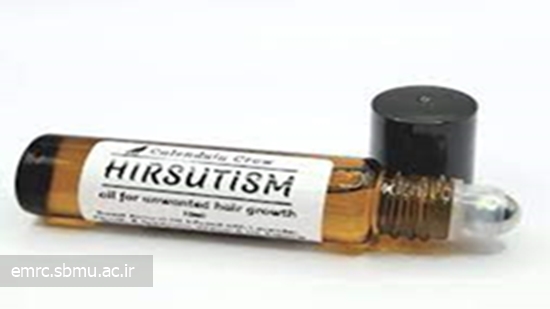 هیرسوتیسم (Hirsutism) 